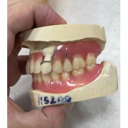 義齒出口 假牙加工廠 義齒外貿(mào)  種植牙出口